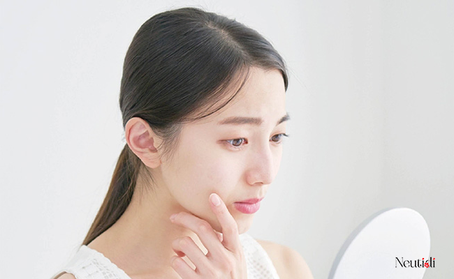 Lưu ý những tác dụng phụ khi sử dụng salicylic acid