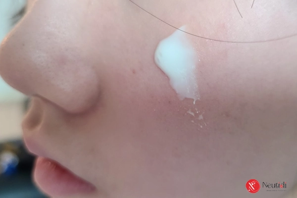 Bôi kem trị mụn bao lâu thì rửa mặt để da sạch mụn mà không kích ứng? 4 Chi tiết các bước sử dụng kem trị mụn