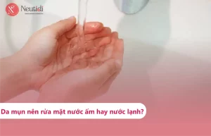 Da mụn nên rửa mặt bằng nước ấm hay nước lạnh