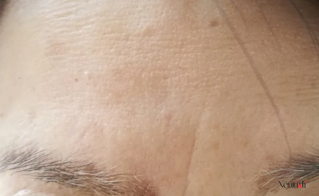 Niacinamide 10% có tác dụng gì? Cách dùng có gì khác biệt? 5 Niacinamide giúp chống lão hóa, giảm nếp nhăn