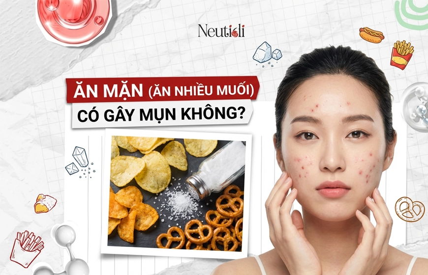 Giải đáp: Ăn mặn (ăn nhiều muối/natri) có gây mụn không? 1 Ăn mặn có gây mụn không?