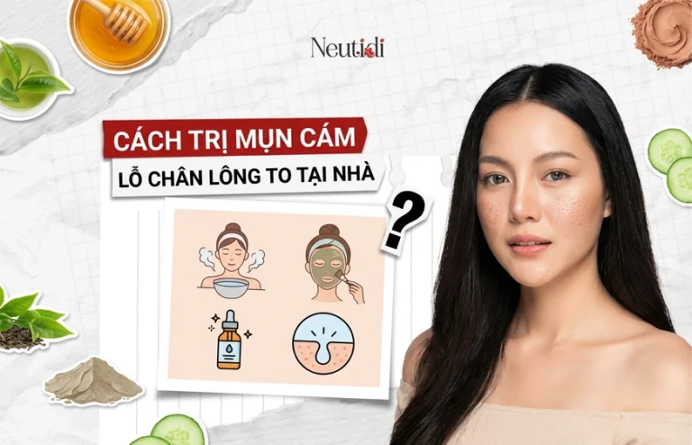 Cách trị mụn cám lỗ chân lông to tại nhà