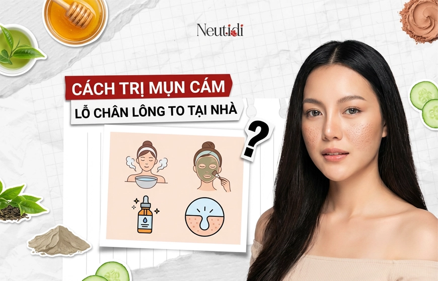 Cách trị mụn cám lỗ chân lông to tại nhà