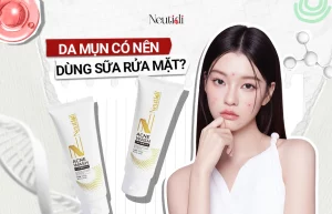 Da mụn có nên dùng sữa rửa mặt?