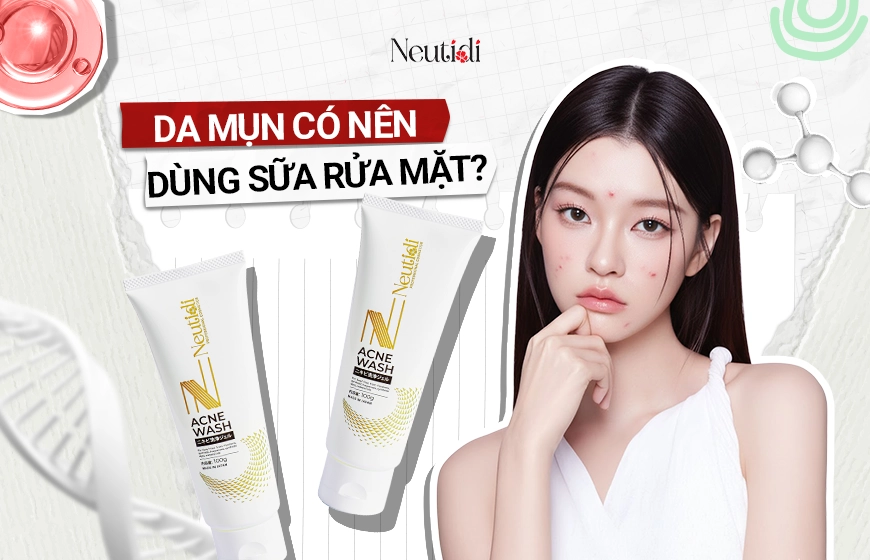Da mụn có nên dùng sữa rửa mặt không? 5 Lưu ý khi chọn & Sử dụng 1 Da mụn có nên dùng sữa rửa mặt?