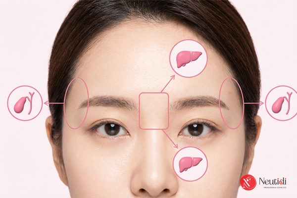 Giải mã 12 vị trí mọc mụn trên mặt: Cảnh báo sức khoẻ gan - phổi - tiêu hoá 8 Mụn ở thái dương và giữa hai lông mày
