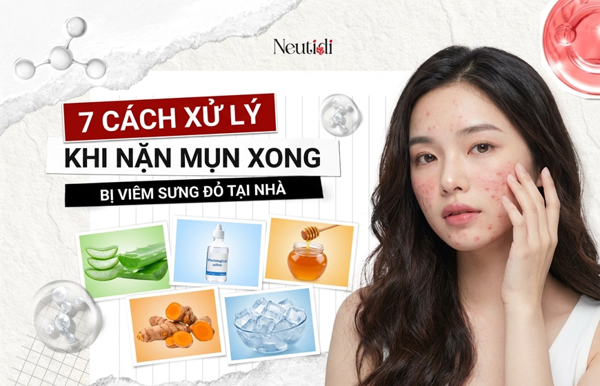 Nặn mụn xong bị viêm, sưng đỏ phải xử lý ra sao