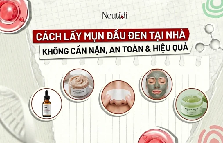 Cách lấy mụn đầu đen tại nhà không cần nặn