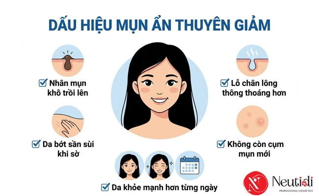 Mụn ẩn có tự hết không? Bao lâu thì khỏi? 4 Dấu hiệu mụn ẩn đang khỏi