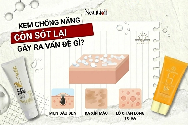 Sữa rửa mặt có làm sạch được kem chống nắng không? 3 Kem chống nắng còn xót lại gây ra vấn đề gì