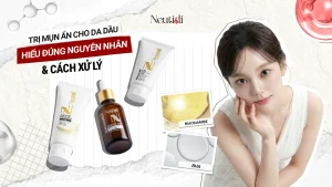 Chia sẻ những cách trị mụn ẩn cho da dầu hiệu quả nhất