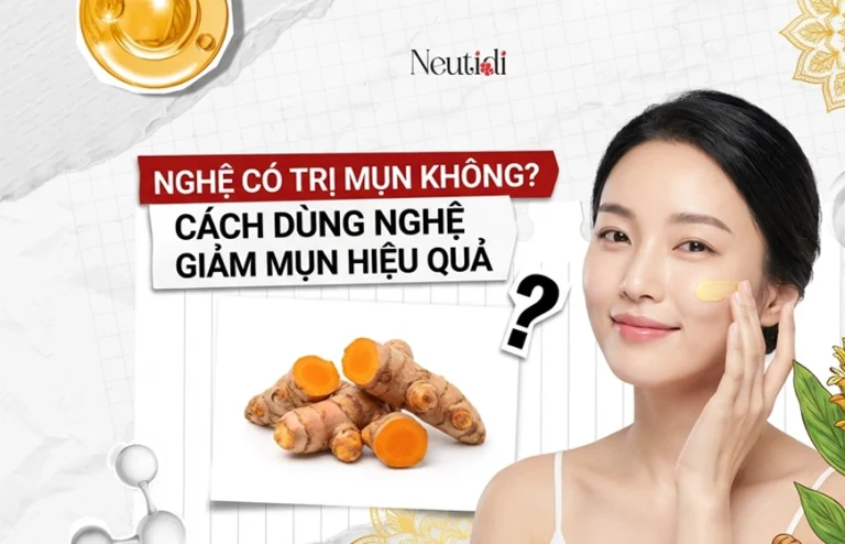 Trị mụn bằng nghệ có hiệu quả không