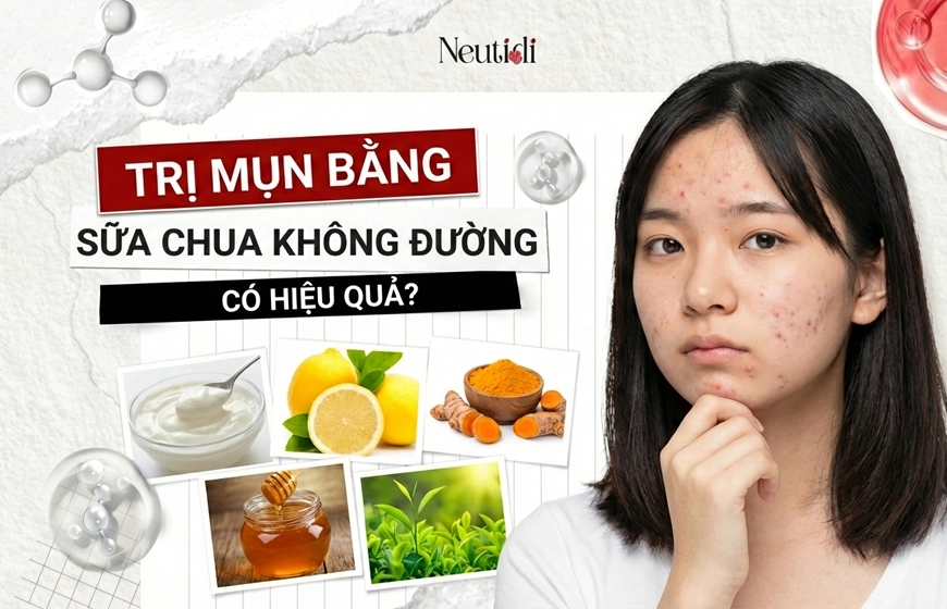5 cách trị mụn bằng sữa chua không đường hiệu quả, đơn giản cho da láng mịn 1 Cách trị mụn bằng sữa chua không đường hiệu quả