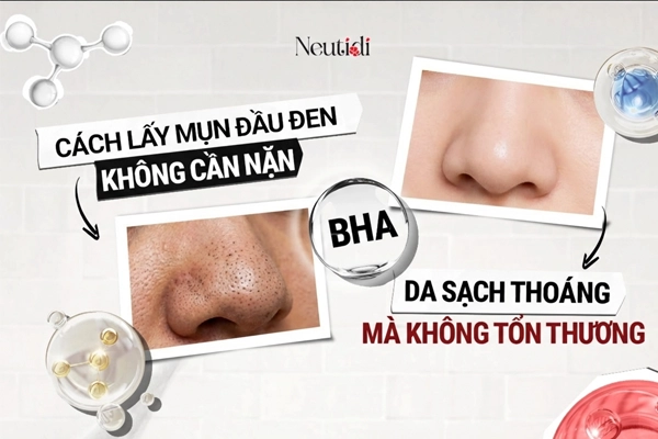 9 Cách trị mụn đầu đen ở mũi tận gốc - hiệu quả ngay tại nhà 5 Trị mụn đầu đen ở mũi tại nhà bằng BHA