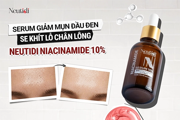 Top 10 sản phẩm trị mụn đầu đen, lỗ chân lông to hiệu quả nhất 2026 3 Serum thu nhỏ lỗ chân lông trị mụn đầu đen Neutidi Niacinamide 10%