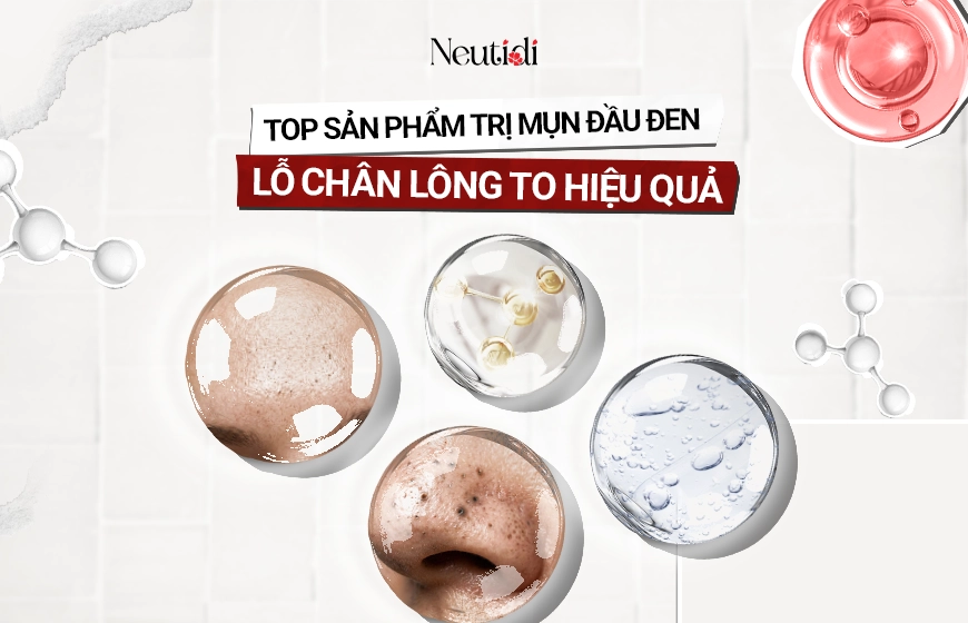 Top 10 sản phẩm trị mụn đầu đen, lỗ chân lông to hiệu quả nhất 2026 1 Sản phẩm trị mụn đầu đen lỗ chân lông to