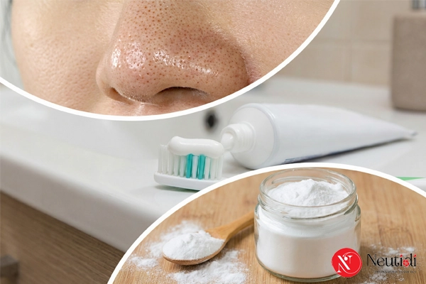 Trị mụn đầu đen ở mũi bằng kem đánh răng có hiệu quả? Thực hiện ra sao? 5 Trị mụn đầu đen bằng kem đánh răng và baking soda