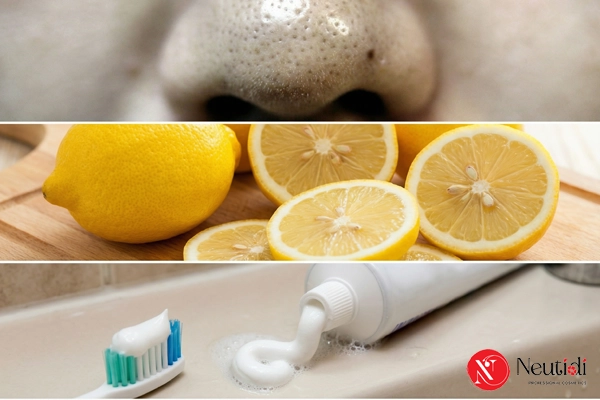 Trị mụn đầu đen ở mũi bằng kem đánh răng có hiệu quả? Thực hiện ra sao? 6 Trị mụn đầu đen ở mũi bằng kem đánh răng và chanh