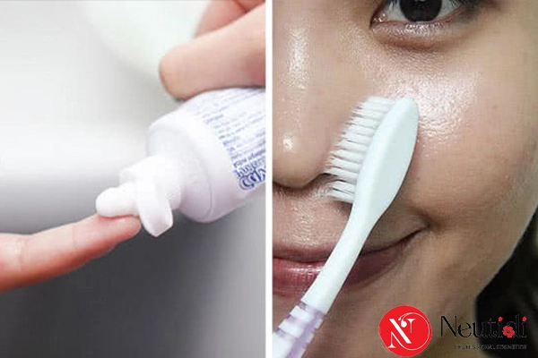 Trị mụn đầu đen ở mũi bằng kem đánh răng có hiệu quả? Thực hiện ra sao? 2 Trị mụn đầu đen bằng kem đánh răng có hiệu quả không
