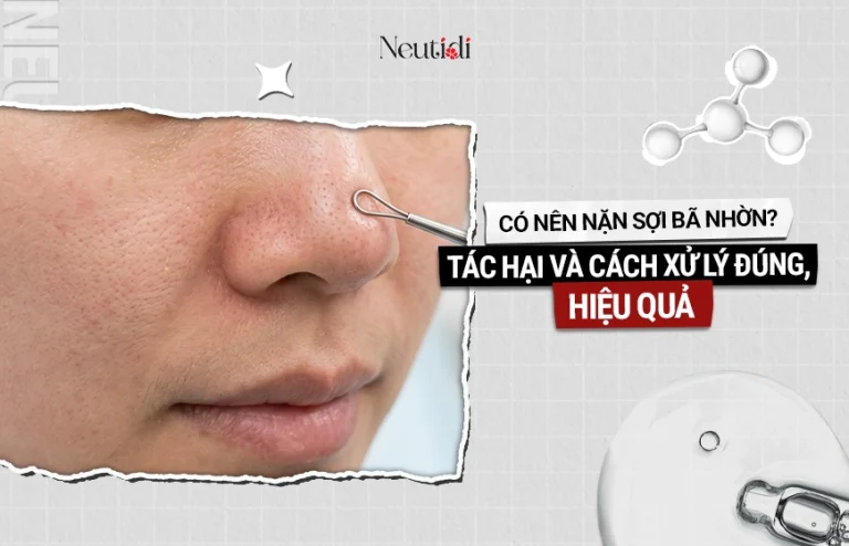 Có nên nặn sợi bã nhờn