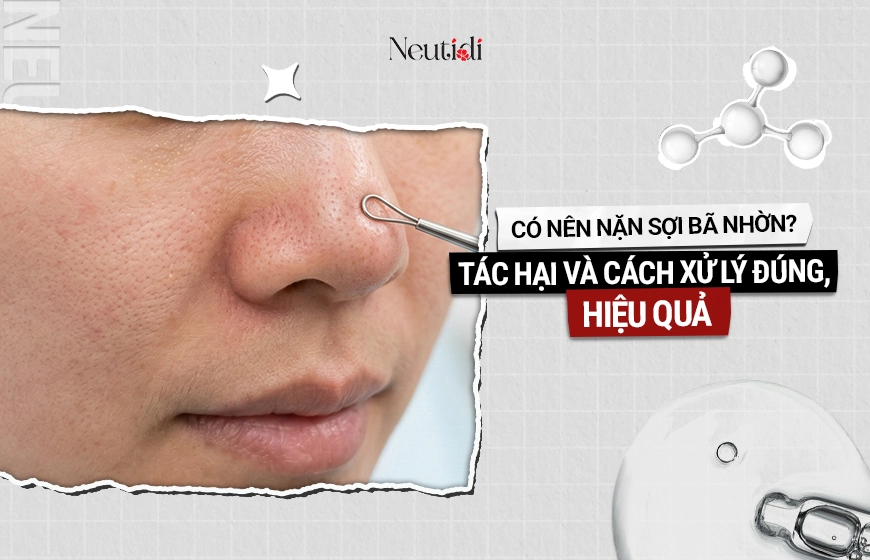 Có nên nặn sợi bã nhờn? Hậu quả & cách xử lý an toàn hơn 1 Có nên nặn sợi bã nhờn