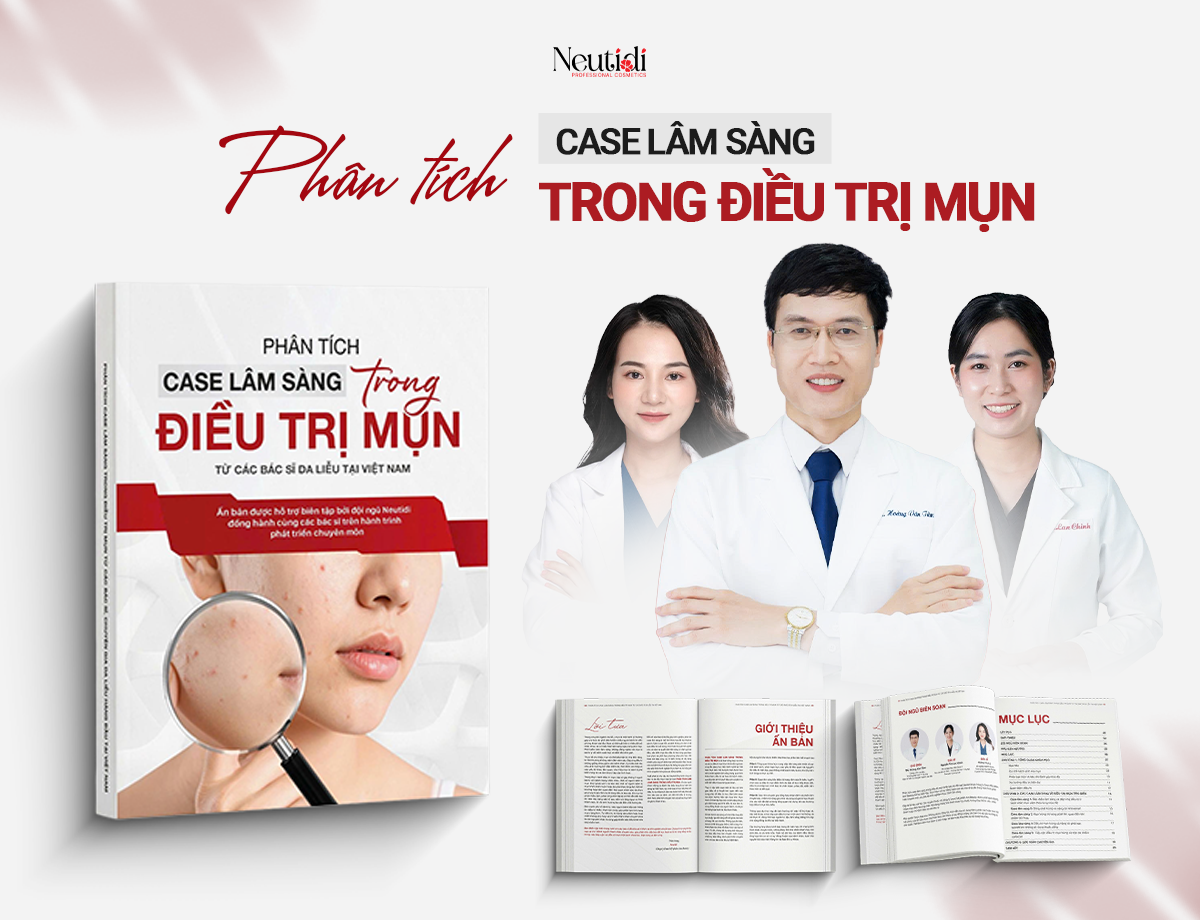 Cơ chế bệnh sinh của mụn trứng cá là gì? 3 Ấn bản: Phân tích ca lâm sàng trong điều trị mụn đã được phát hành bởi Neutidi