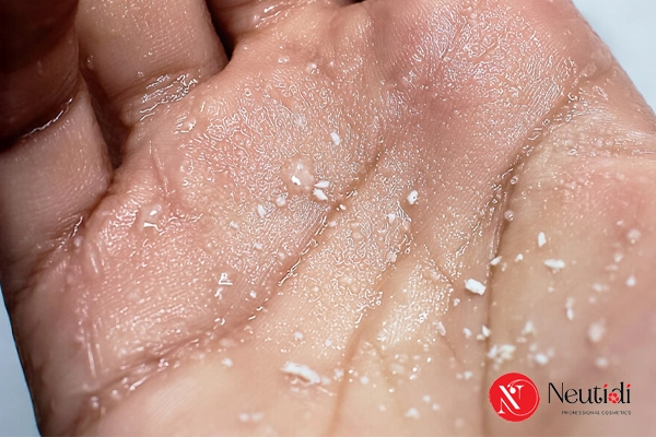 Mụn cám ở cằm: Nguyên nhân & 7 cách trị hiệu quả tại nhà 5 Tẩy tế bào chết bằng BHA trị mụn cám ở cằm