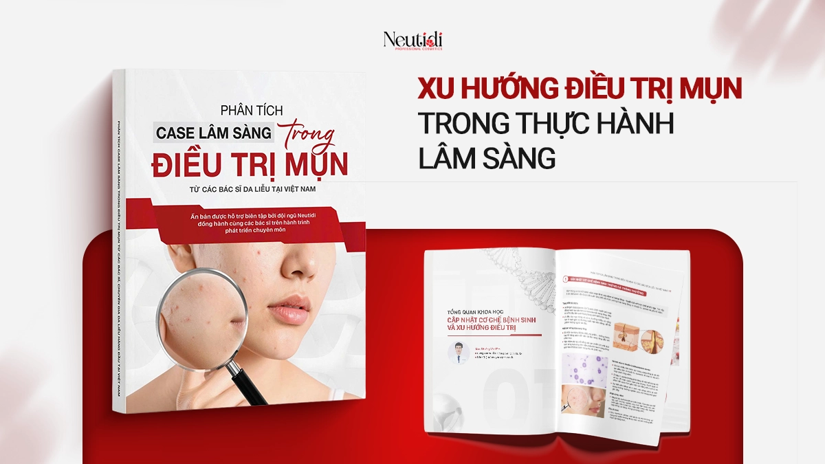 Xu hướng điều trị mụn trong thực hành lâm sàng 4 Xu hướng điều trị mụn - trích "Phân tích ca lâm sàng trong điều trị mụn"