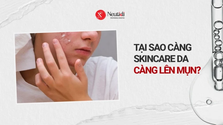 Tại sao càng skincare càng lên mụn
