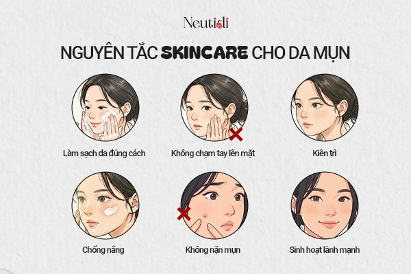 Nguyên tắc skincare cho da mụn