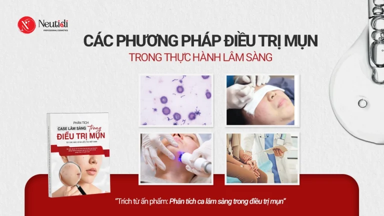 Các phương pháp điều trị mụn trong thực hành lâm sàng
