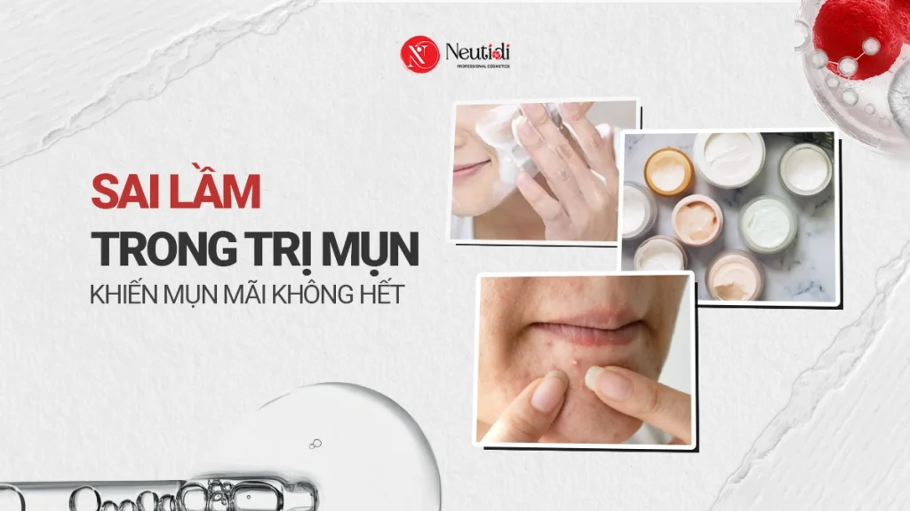 Những sai lầm khi trị mụn