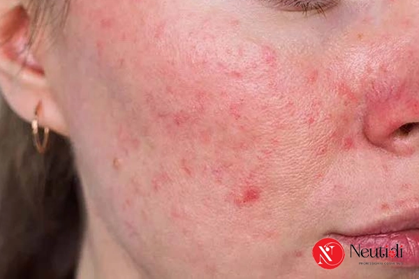 Thói quen sinh hoạt