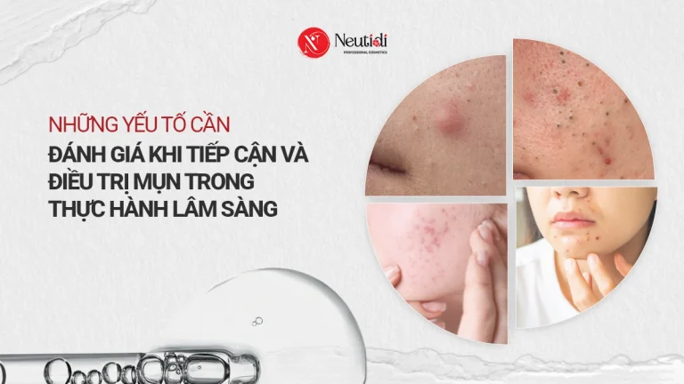 Những yếu tố cần đánh giá khi tiếp cận ca mụn