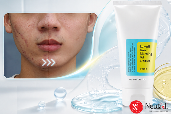 Top 6 sữa rửa mặt trị mụn cho nam 2026: Đừng chọn bừa kẻo da tệ hơn 3 Cosrx Low pH Good Morning Gel Cleanser - sữa rửa mặt giảm mụn cho nam