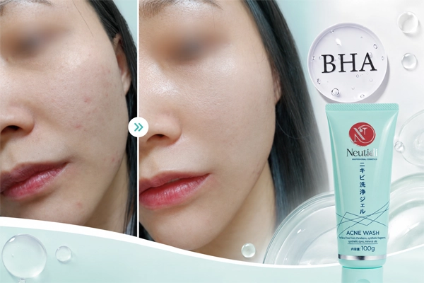 BHA hoạt chất thu nhỏ lỗ chân lông hiệu quả