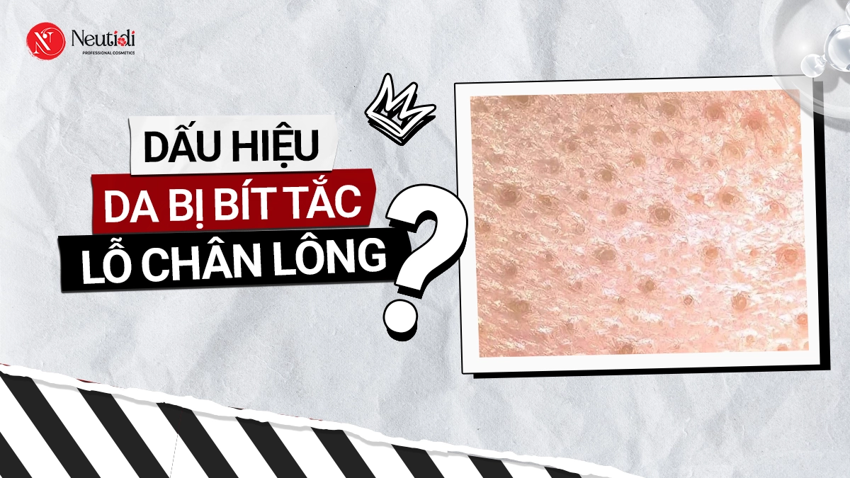 Dấu hiệu da mặt bị bít tắc lỗ chân lông & 5 bước xử lý hiệu quả 17 Bít tắc lỗ chân lông là gì