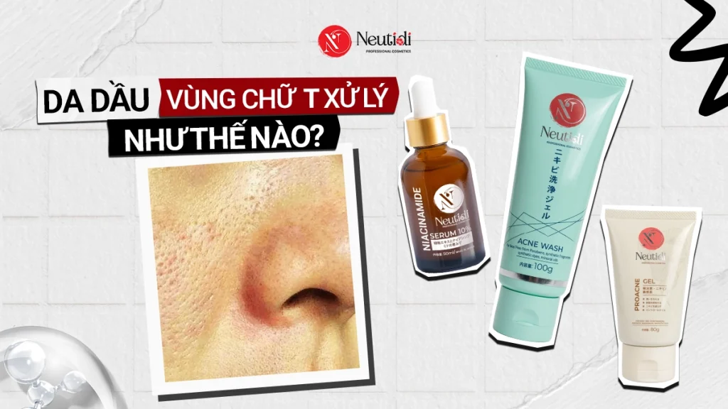 Da dầu vùng chữ T