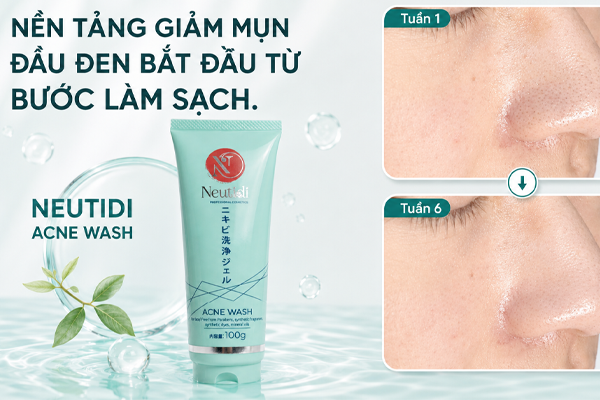 giam mun dau den neutidi acne wash