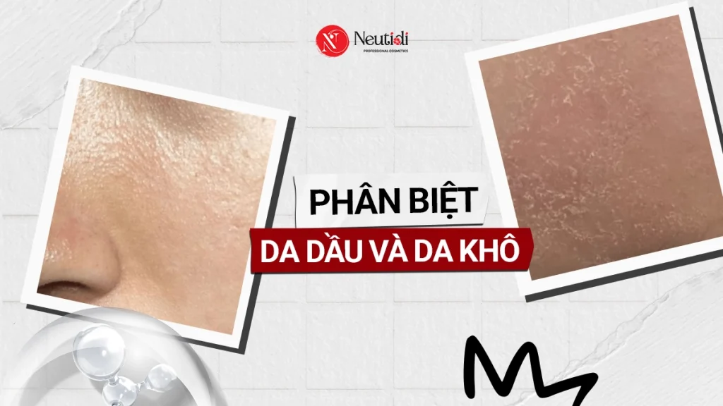 Cách phân biệt da dầu và da khô