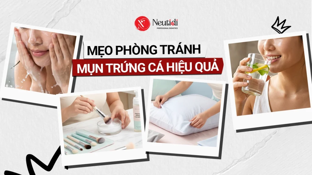 Mẹo Phòng tránh mụn trứng cá hiệu quả