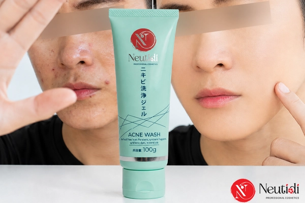 Sữa rửa mặt chứa BHA từ Neutidi - Neutidi Acne Wash