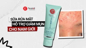 TOP Sữa rửa mặt trị mụn cho nam 2026