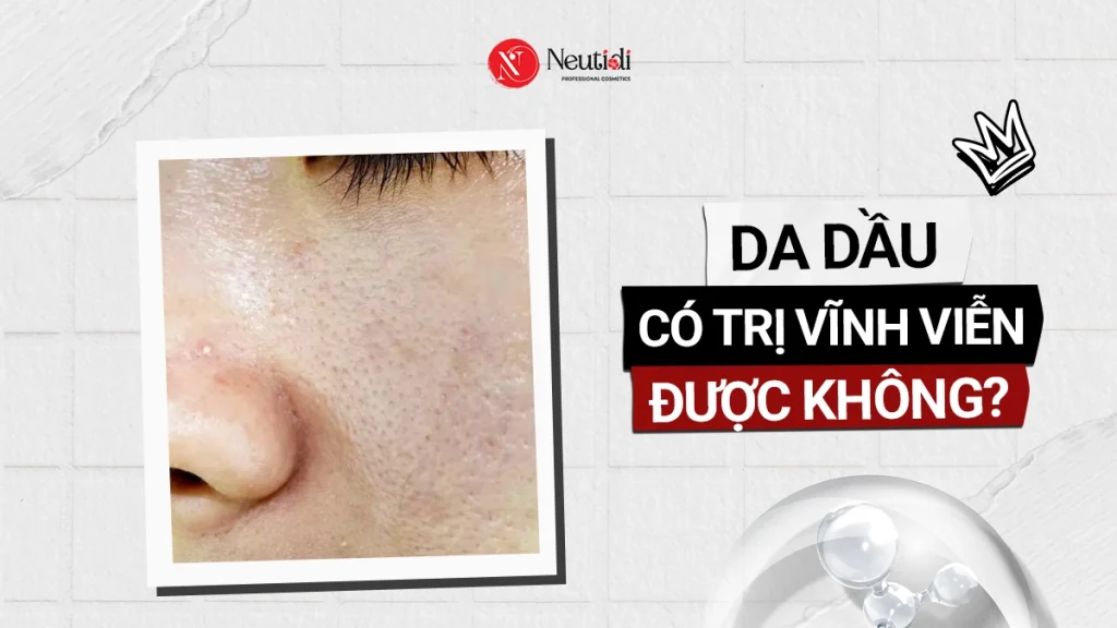 Trị da dầu vĩnh viễn được không? Nên xử lý đúng như thế nào? 1 Da dầu có trị vĩnh viễn được không?