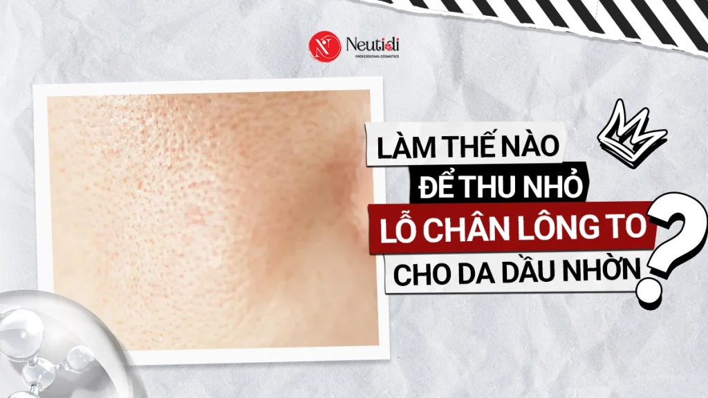 Xử lý lỗ chân lông to cho da nhờn hiệu quả tại nhà 1 Cách trị lỗ chân lông to cho da nhờn hiệu quả