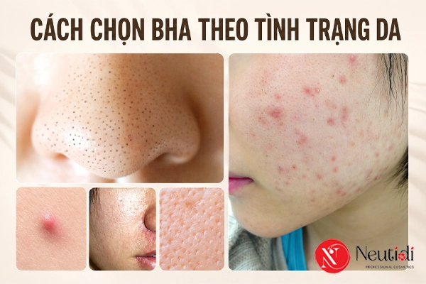 Chọn BHA theo tình trạng da