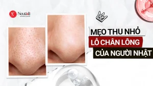Mẹo thu nhỏ lỗ chân lông của người Nhật Bản
