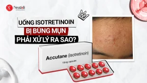 Dùng isotretinoin bị bùng mụn phải làm sao? Bao lâu thì hết?