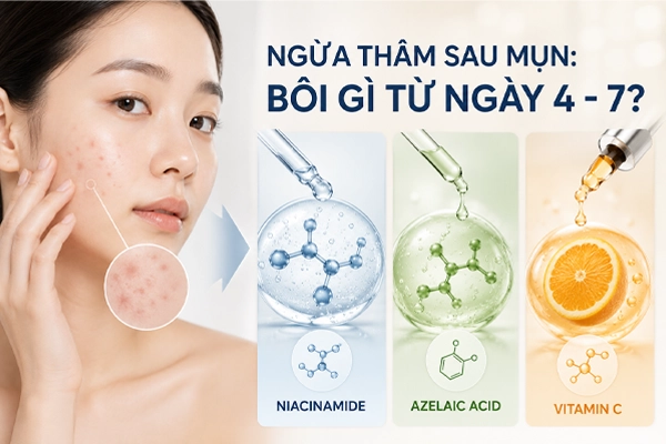 Bôi gì để ngừa thâm sau khi nặn mụn?