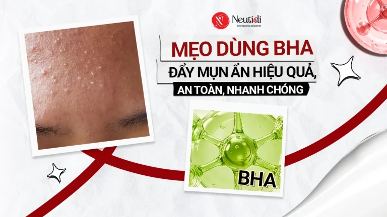 Mẹo dùng BHA trị mụn ẩn